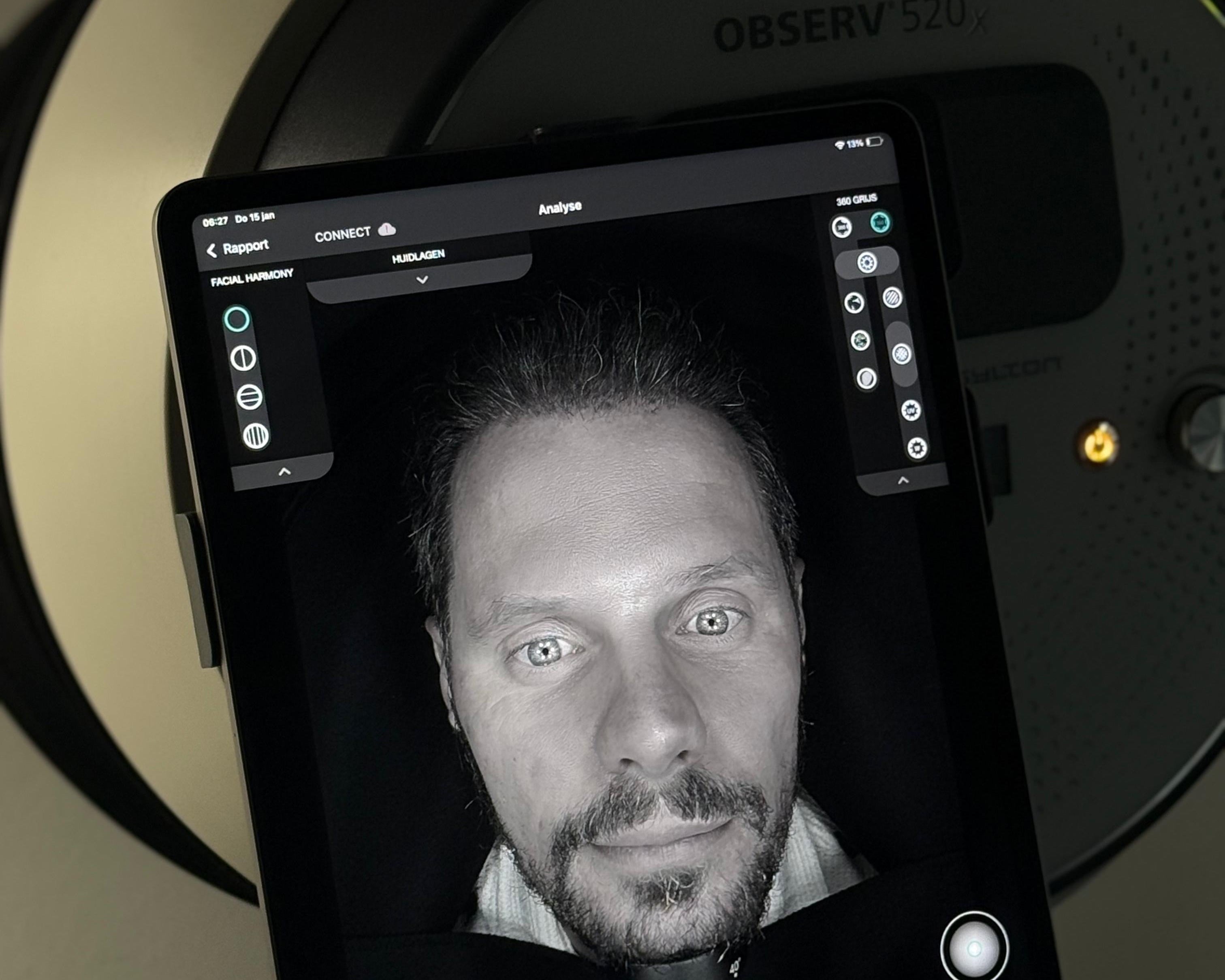 Mr._Adam_Observ_Skin_Scan